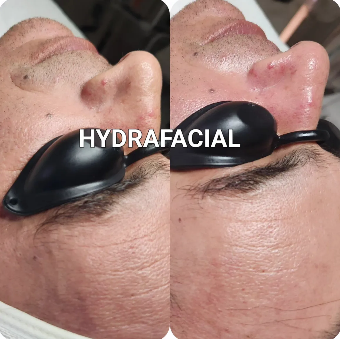 Esthetician Carineh applying a hydrating mask during a facial at Glow Skin Spa